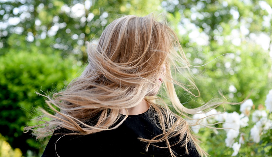 What causes female hair loss at temples