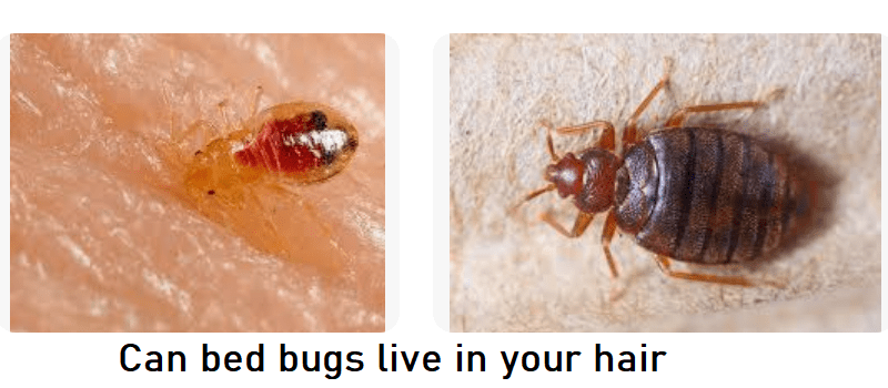 Can Bed Bugs Live In Your Hair