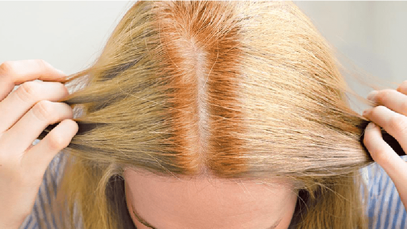 1. How to Fix Patchy Blonde Hair Dye - wide 10
